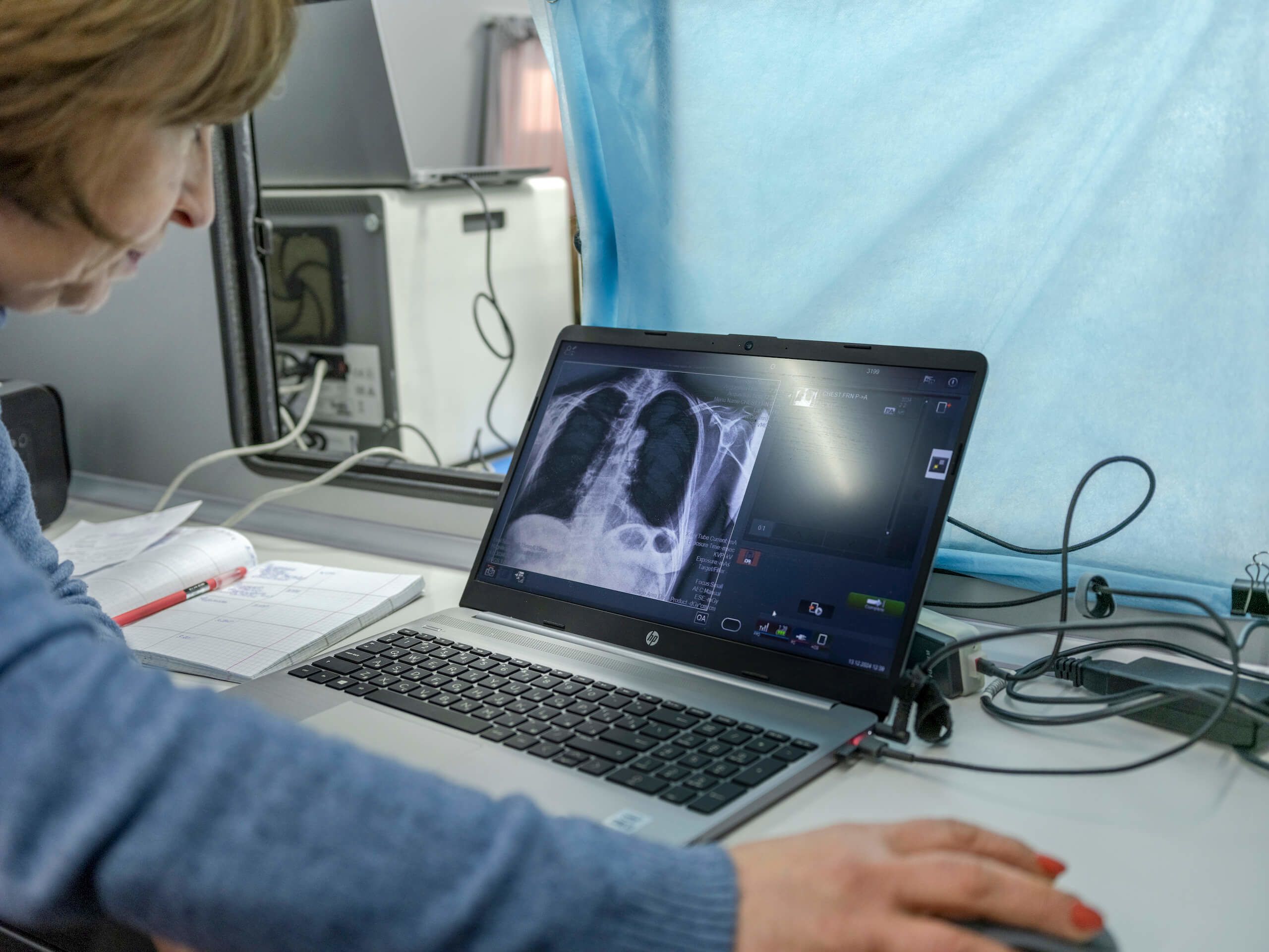 A healthcare worker doing an X-ray screening of a patient who showed up at the mobile clinic in Svyatohirsk, the war-hit town in Donetsk region, Ukraine on Dec. 13, 2024